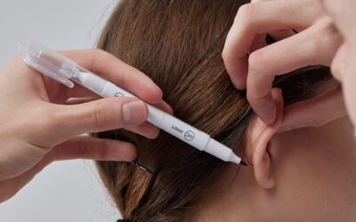 Otoplastia en Sevilla: recupera tu confianza y deja atrás los complejos