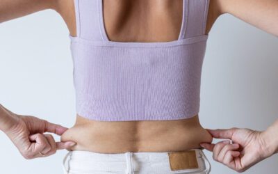 Lipoescultura en la espalda: mejora el contorno y recupera tu silueta