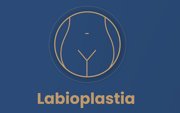 Labioplastia: una cirugía rápida sin hospitalización y cómo es su recuperación