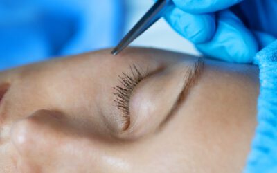 Blefaroplastia: cirugías complementarias para potenciar el rejuvenecimiento facial