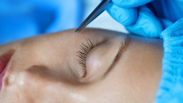 Blefaroplastia: cirugías complementarias para potenciar el rejuvenecimiento facial