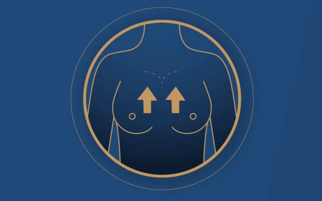 polo superior sin implantes