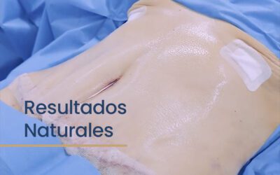 ¿Por qué la cirugía estética a veces tiene resultados naturales y a veces no?