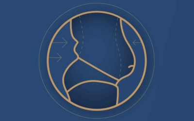 Inicio 15 Soft Definition Lipo: ¿en qué consiste la definición abdominal natural?
